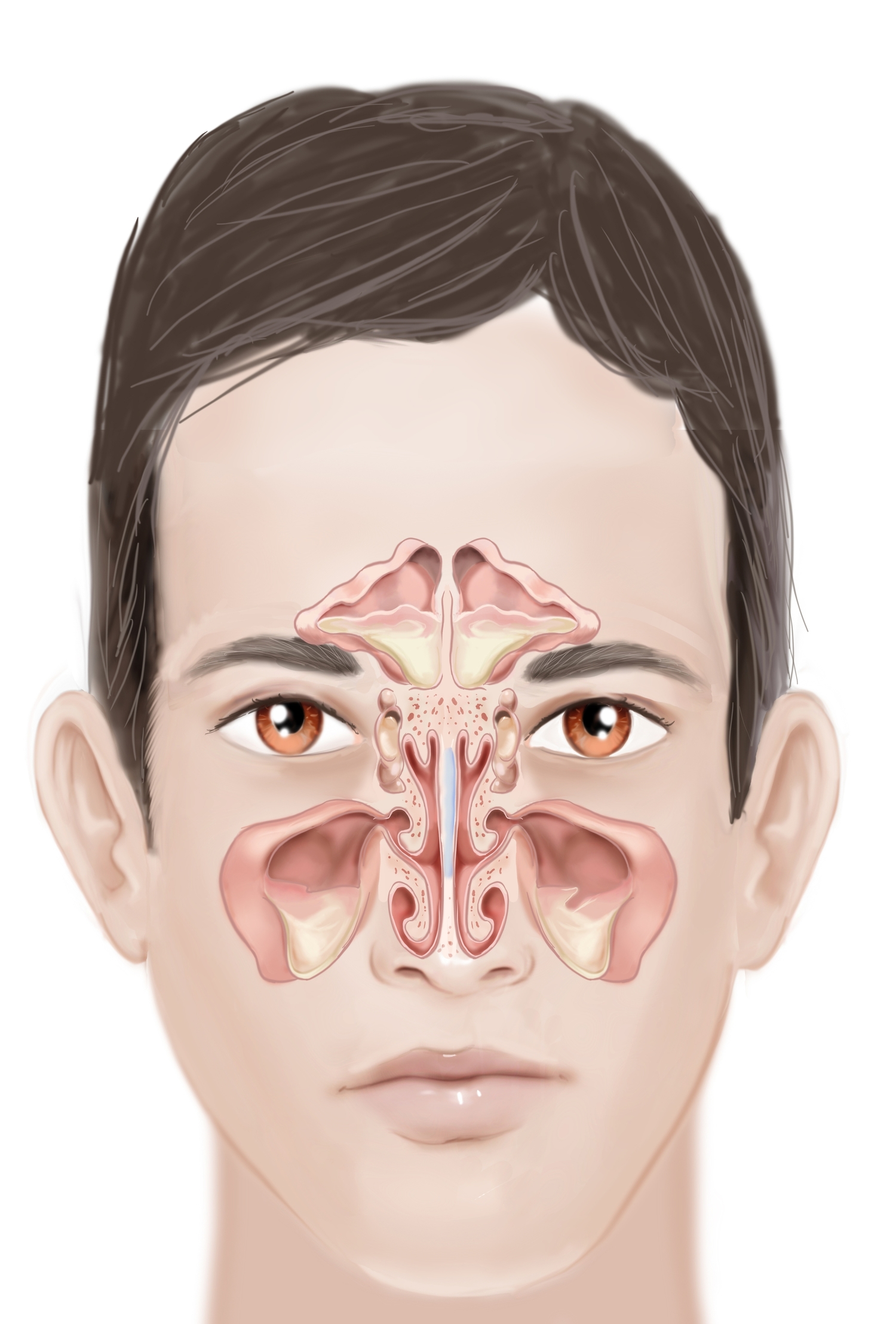 Sinusitis — Calgary Sinus Centre