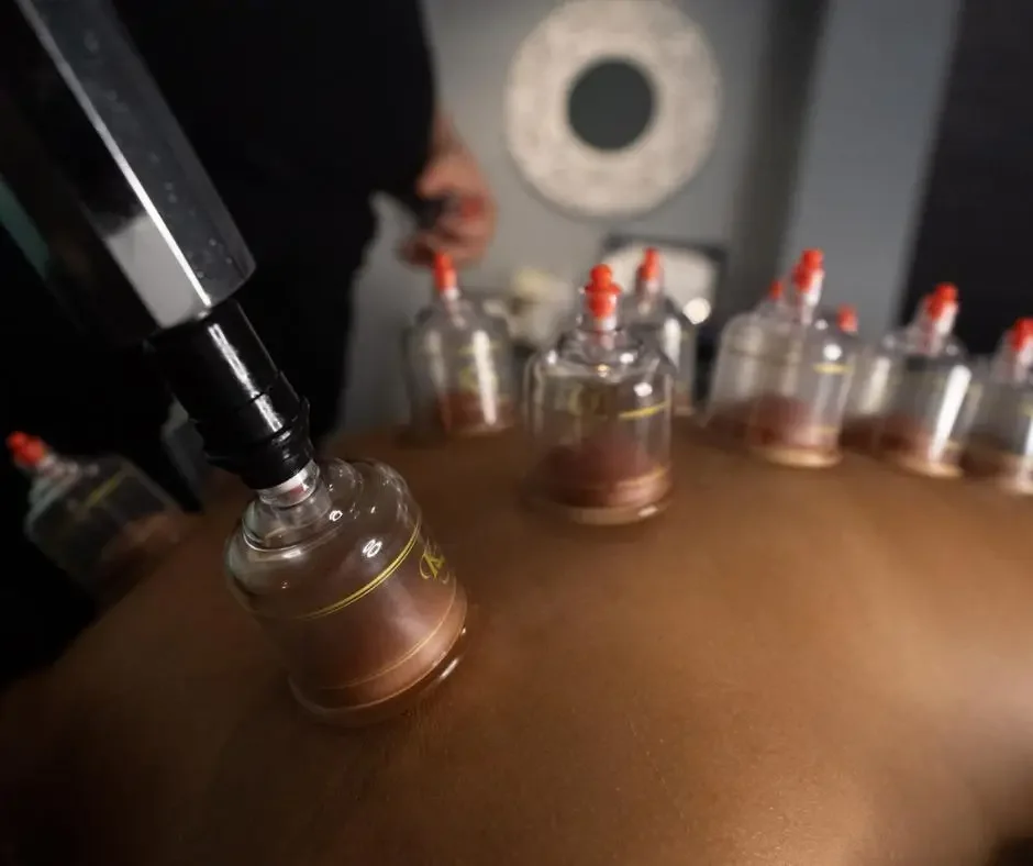 Cupping therapy being applied with suction pump tool during a session at Massage Hope Leesburg VA