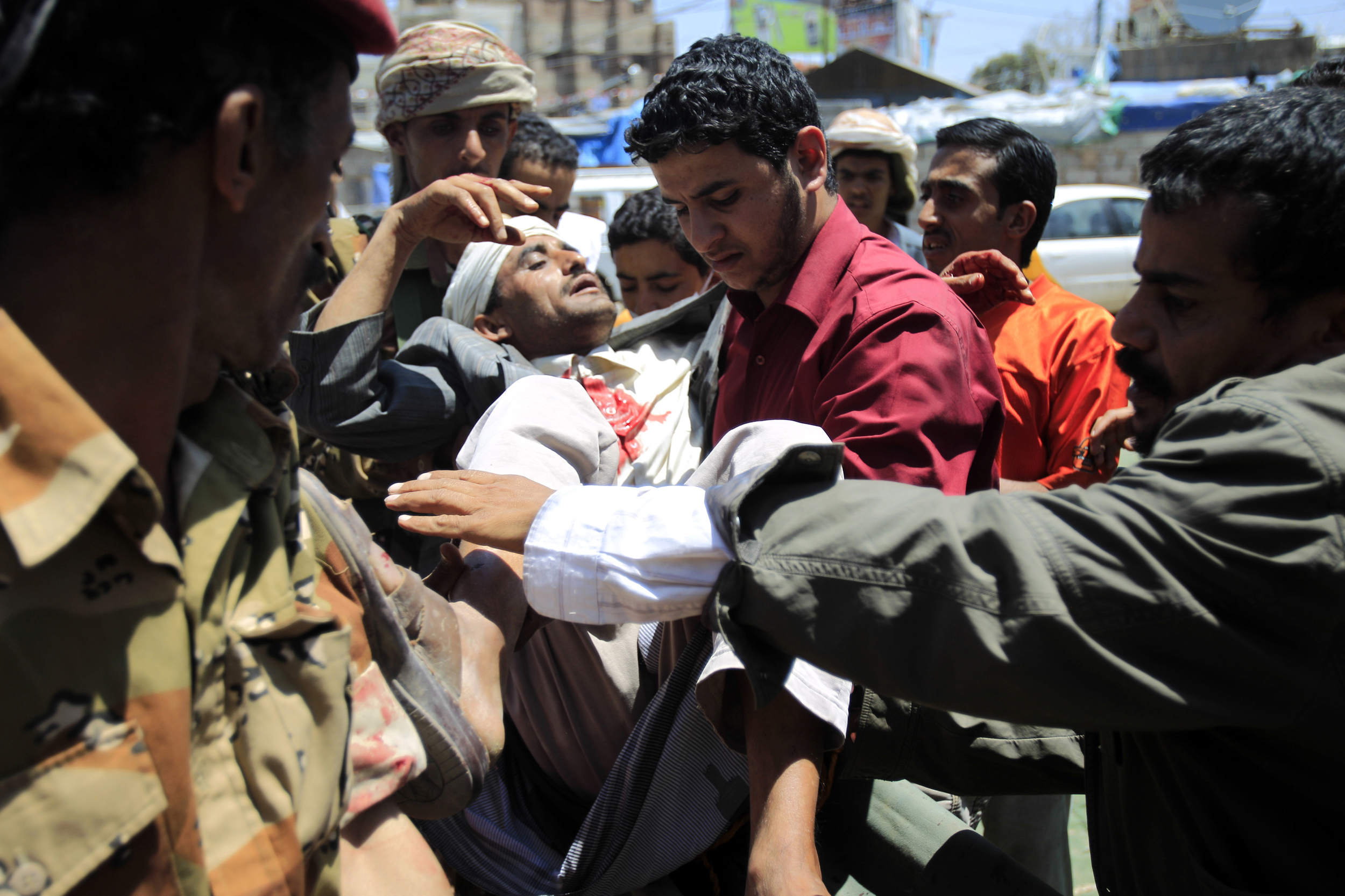 Wounded protester, Sana'a, last Thursday - Courtesy of Reuters/BRACK