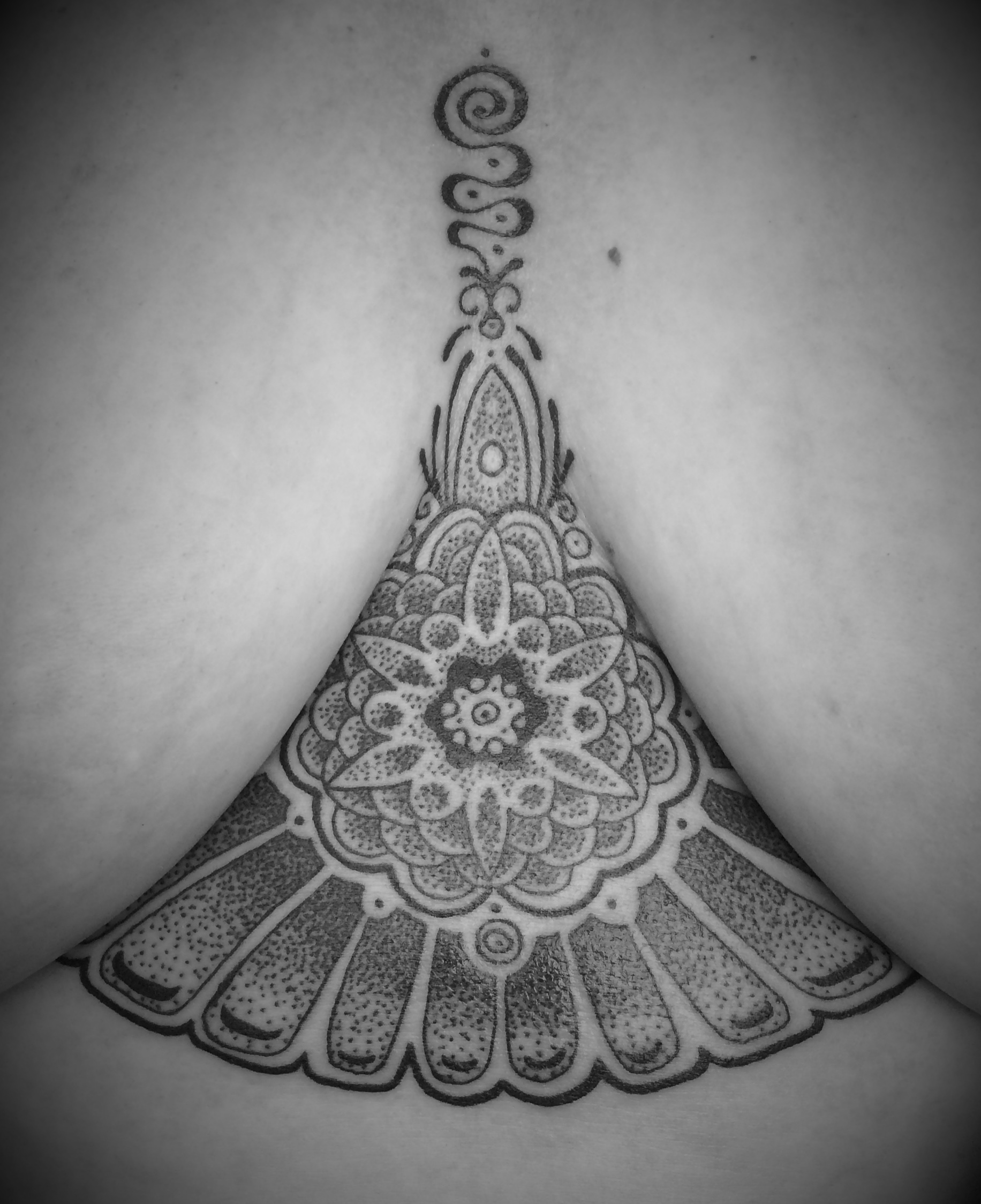 Terri's Sternum