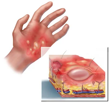 Medical legal generic exhibit