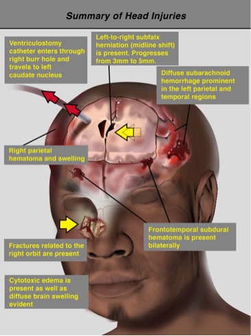 Medical legal: Summary of injuries