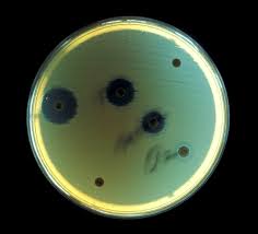 No... that is not how yeast should look!