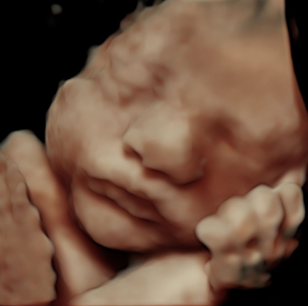 Screen Shot 2018-02-10 at 3.31.48 PM.png