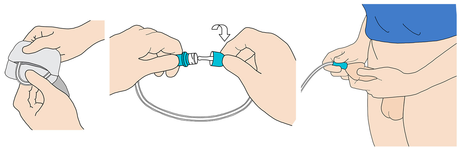 Medical illustration
