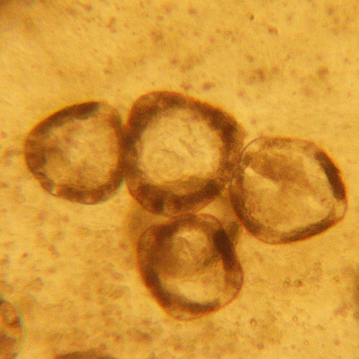 Eggs in a tapeworm segment x10 110414.jpg