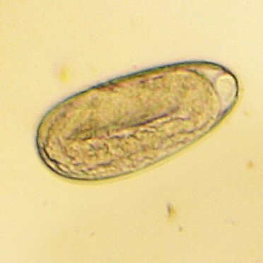 2Moving worm in eggs.jpg