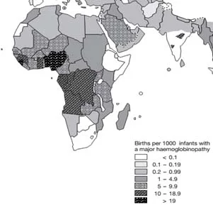 Global distribution of haemoglobin disorders in terms of births of affected infants per 1000 births