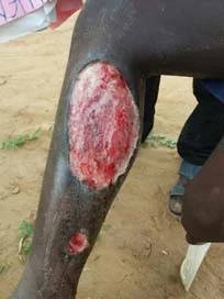 The snake bite wound