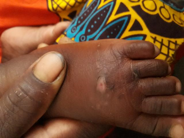 The case in Simwatachela &nbsp;&nbsp;&nbsp;&nbsp;&nbsp;&nbsp;&nbsp;&nbsp;&nbsp;&nbsp;&nbsp;&nbsp;&nbsp;&nbsp;&nbsp;&nbsp;&nbsp;&nbsp;&nbsp;&nbsp;&nbsp;&nbsp;&nbsp;&nbsp;&nbsp;&nbsp;&nbsp;&nbsp;&nbsp;&nbsp;&nbsp;&nbsp;&nbsp;&nbsp;&nbsp;&nbsp;&nbsp;&n…