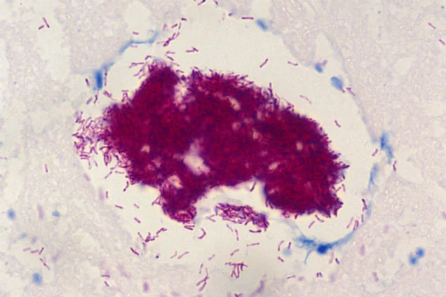 Photo credit: J. Buntine, WHO