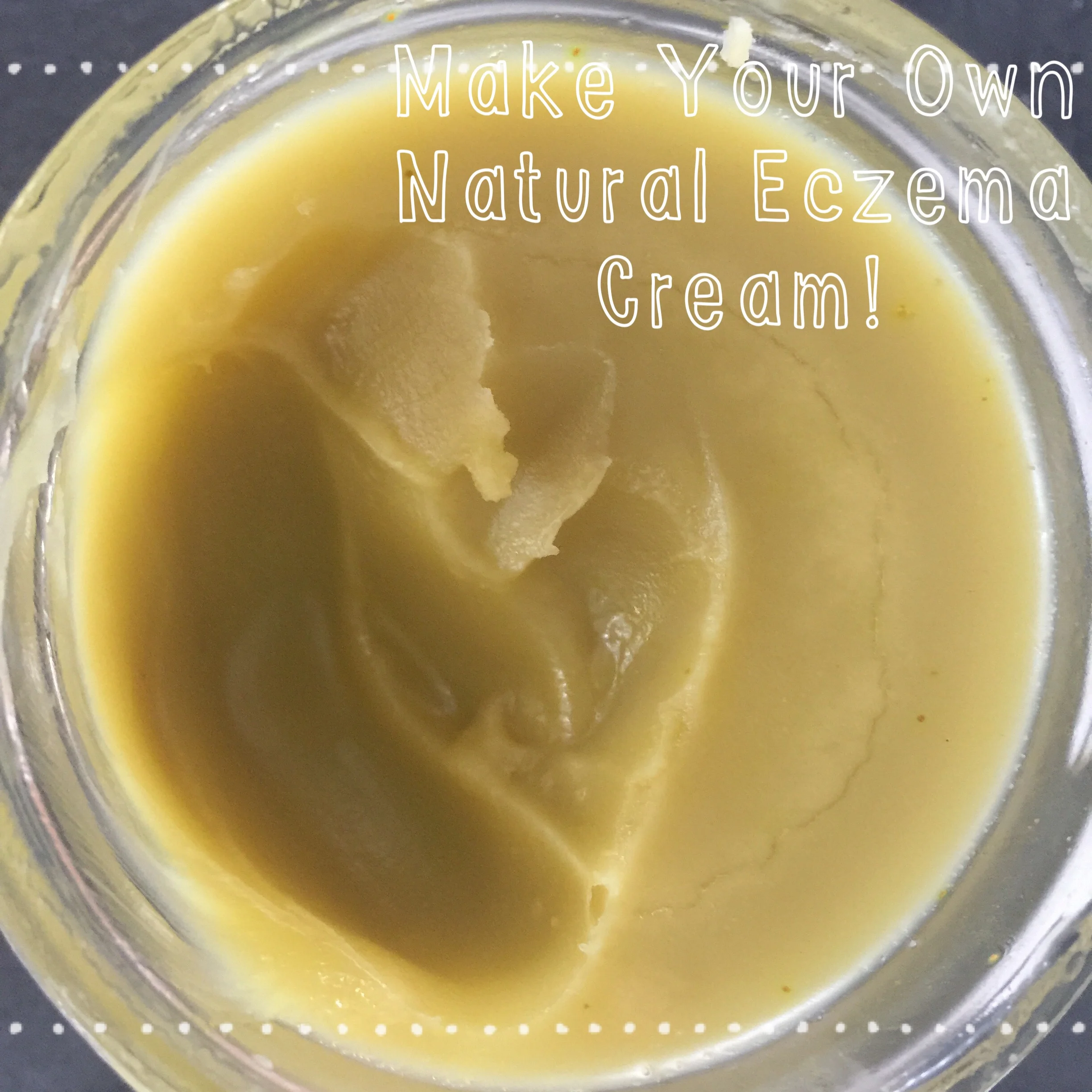 All Natural Eczema Cream You Can Make At Home