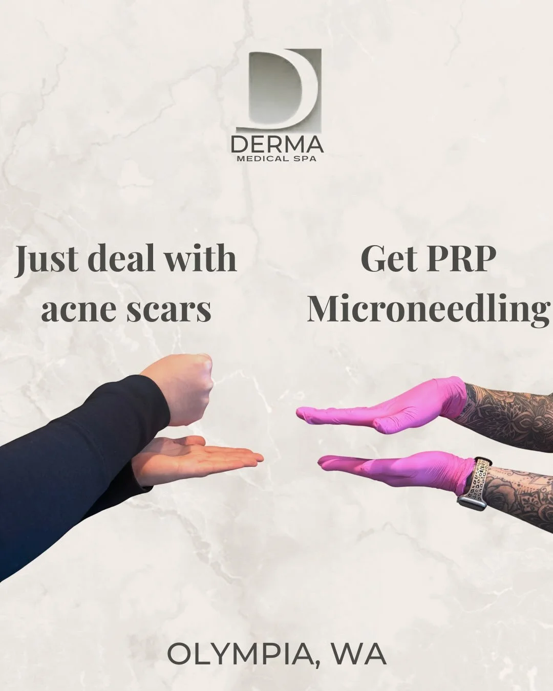 True self care is about giving yourself permission to prioritize how you feel 😍 The laundry can wait, book the treatment 🤍 #medspa #microneedling #acnescars #beauty #confidence