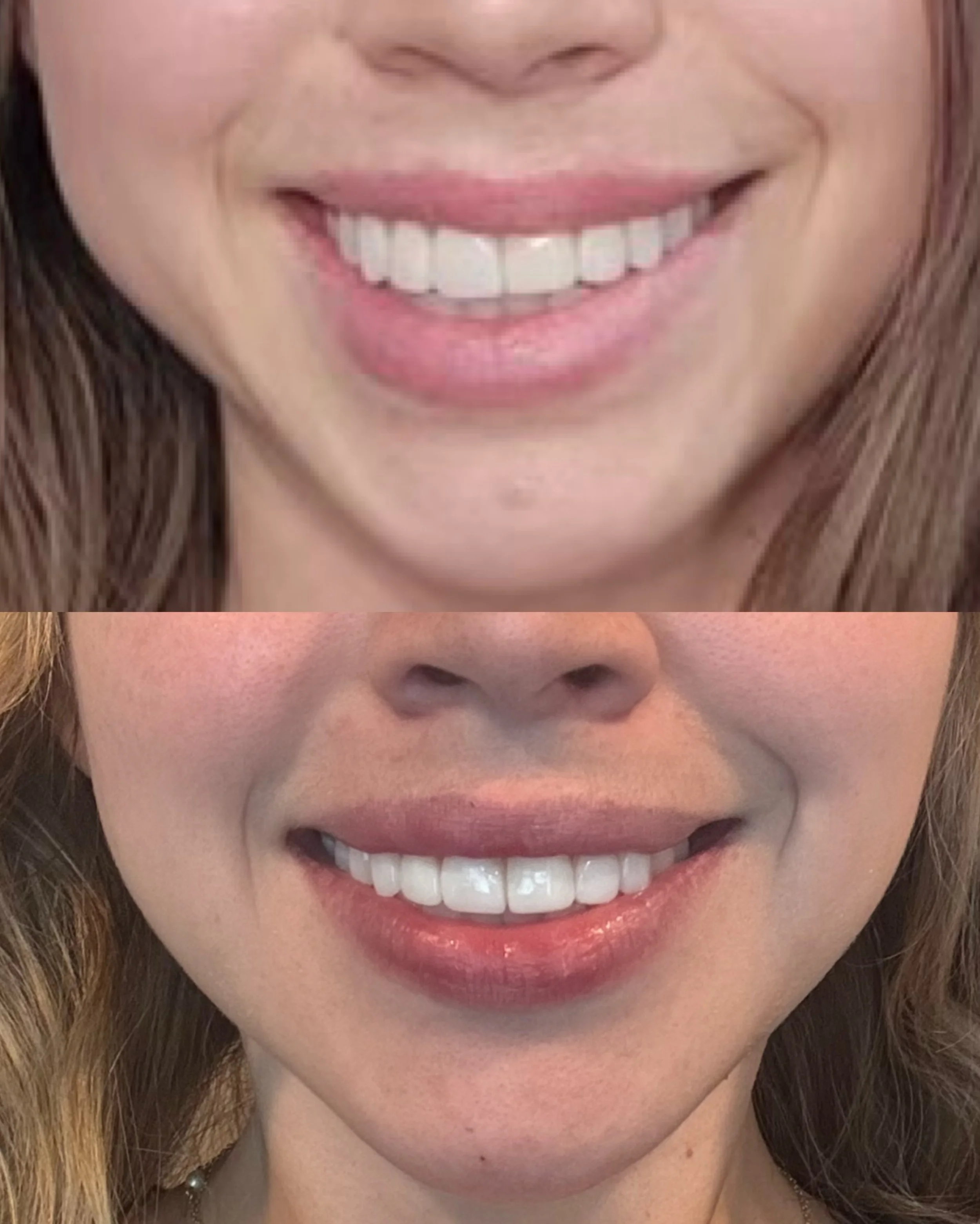 Did you know Botox can also help treat asymmetry? 👀
From uneven brows to asymmetrical smiles, subtle adjustments can make a world of difference. We&rsquo;re all about boosting your confidence and helping you love every detail of your face!😍
Have a 