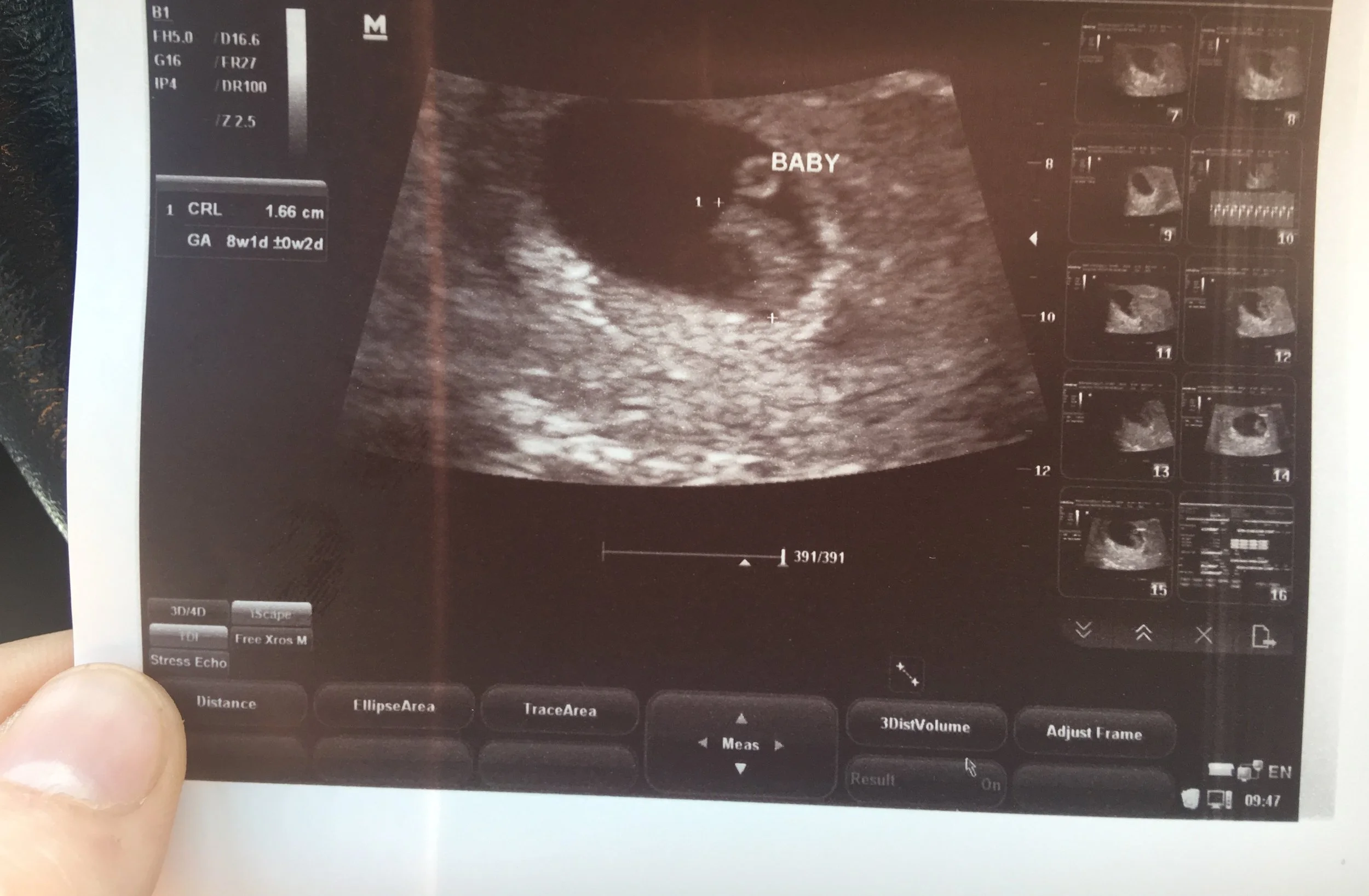 Is it just me or does my little fetus look a little bit like a llama?! 