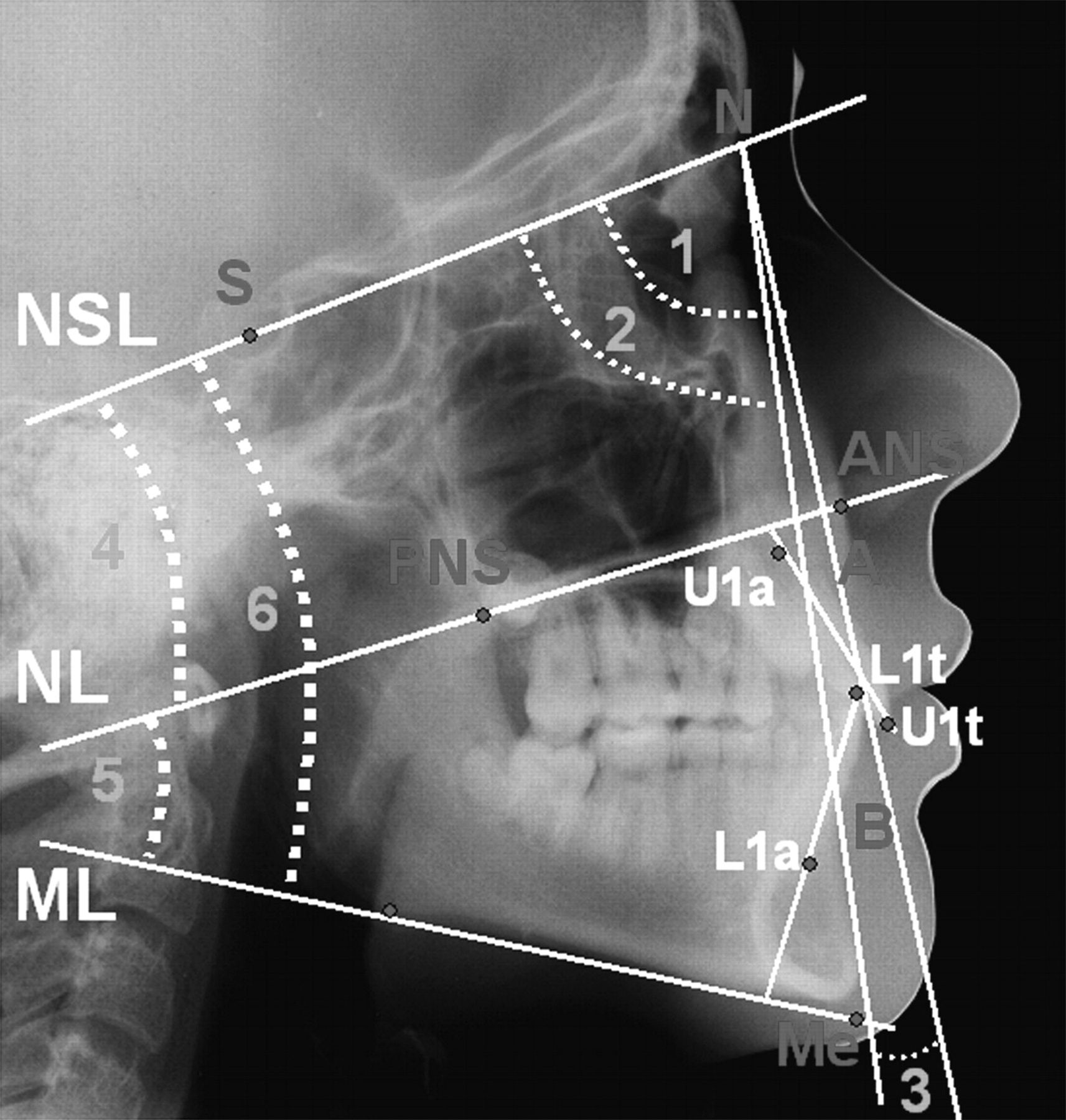 X-ray Measurements | Swapp Orthodontics | Orthodontist | Mansfield, TX