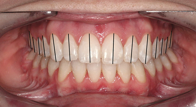 Dental Characteristics | Swapp Orthodontics | Orthodontist | Mansfield, TX
