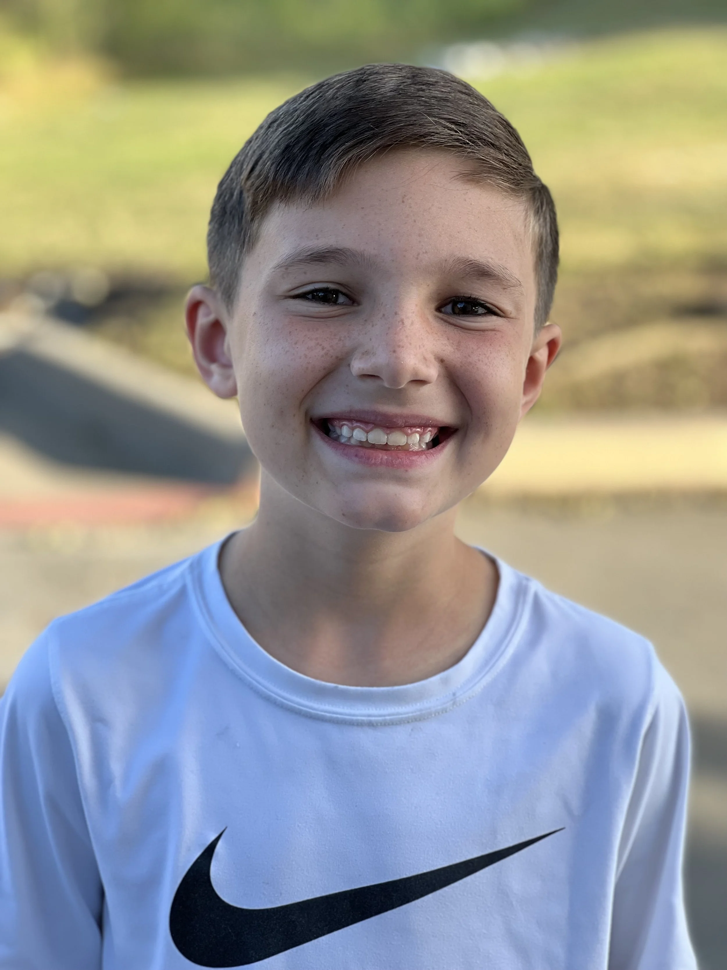 No more braces! My son finished his first phase of treatment.