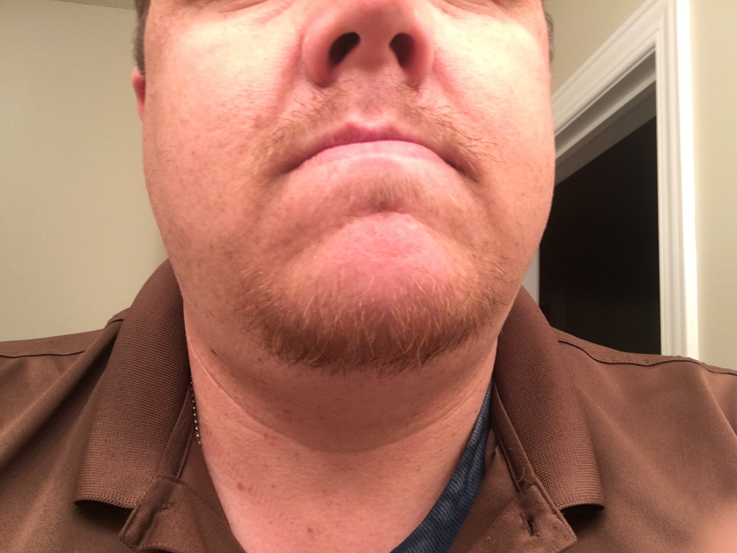 2018 Hair Experiment