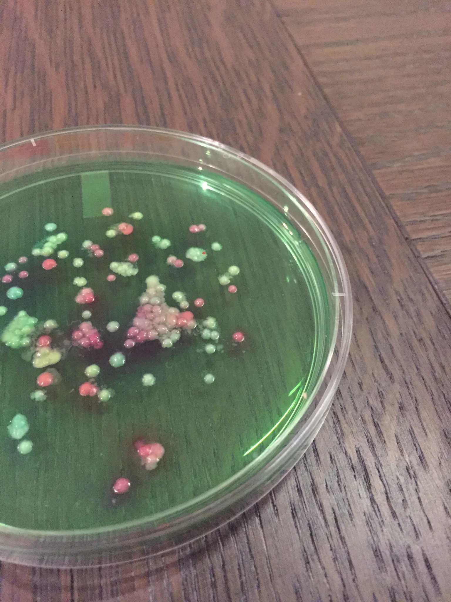 Jello filled Petri Dish