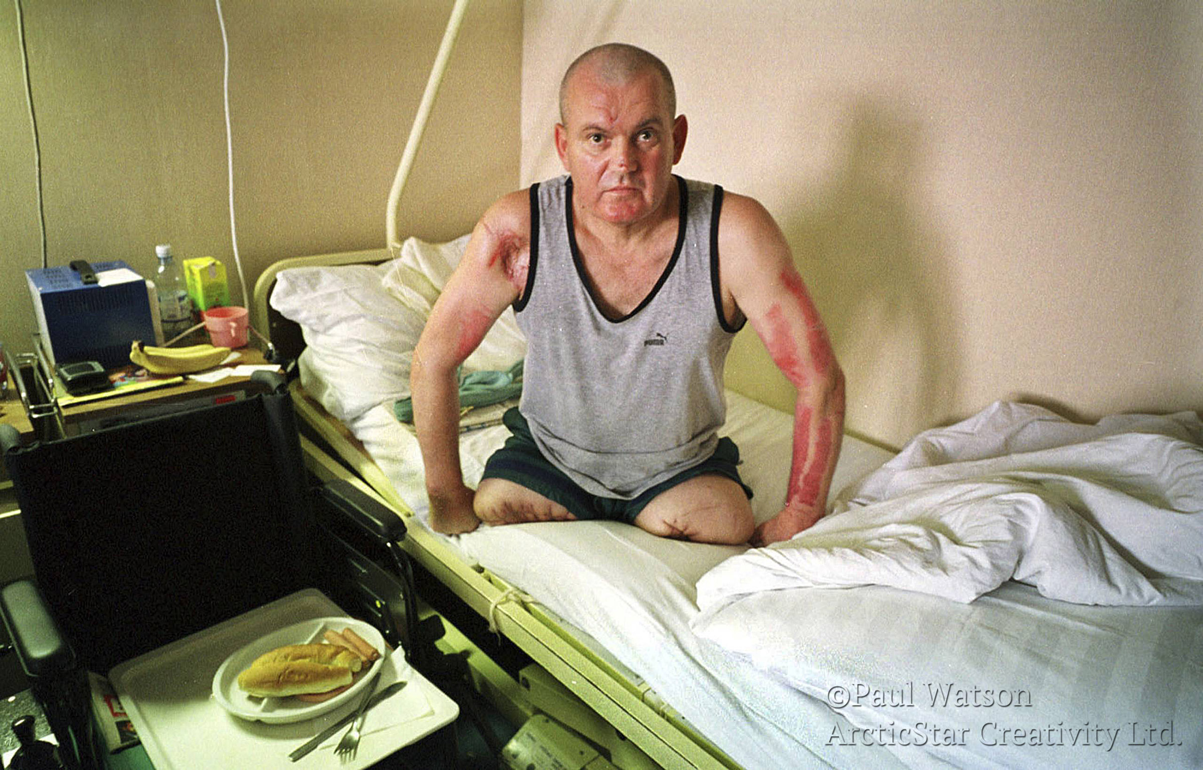 Web Serbian Cop Amputated.jpg
