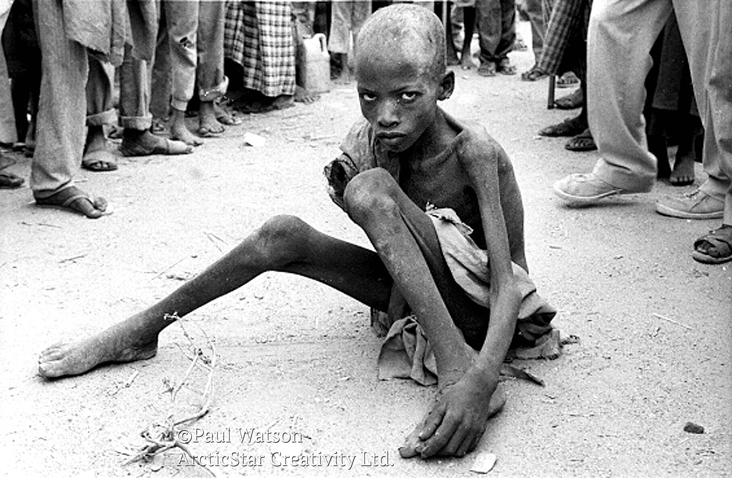 Web Somali Famine Boy.jpg