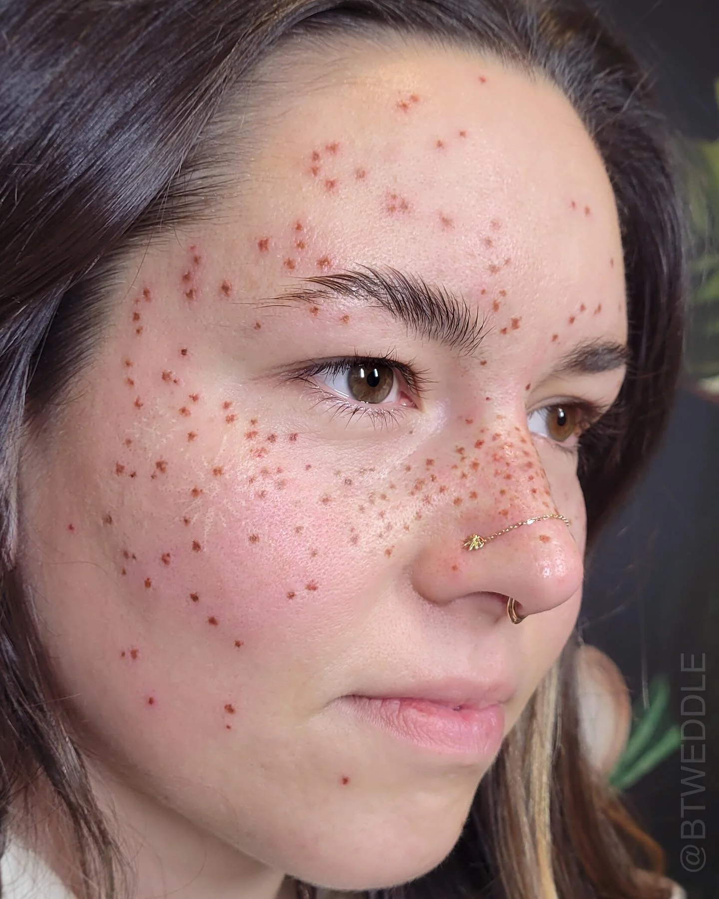 A whole face of freshly tattooed freckles for my long-time client. Thanks for letting me tattoo a whole bunch of lovely dots on your face again! 🥰 
.
.
.
.
.
.
.
.
.
#freckletattoo #freckles #fauxfreckles #bfreckle #fakefreckles #gastown #vancouvert