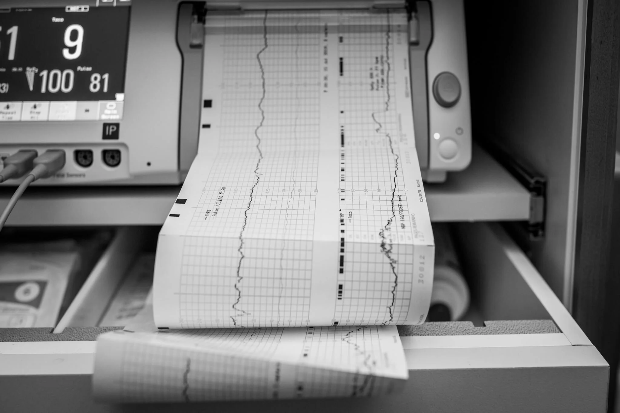 hospital birth baby mom contraction monitor