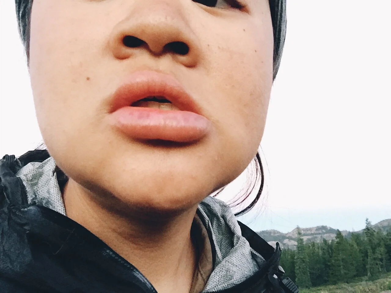 I waited till it got lighter to take a pic of my lip but the swelling went way down already. It was SO much bigger when I woke up.