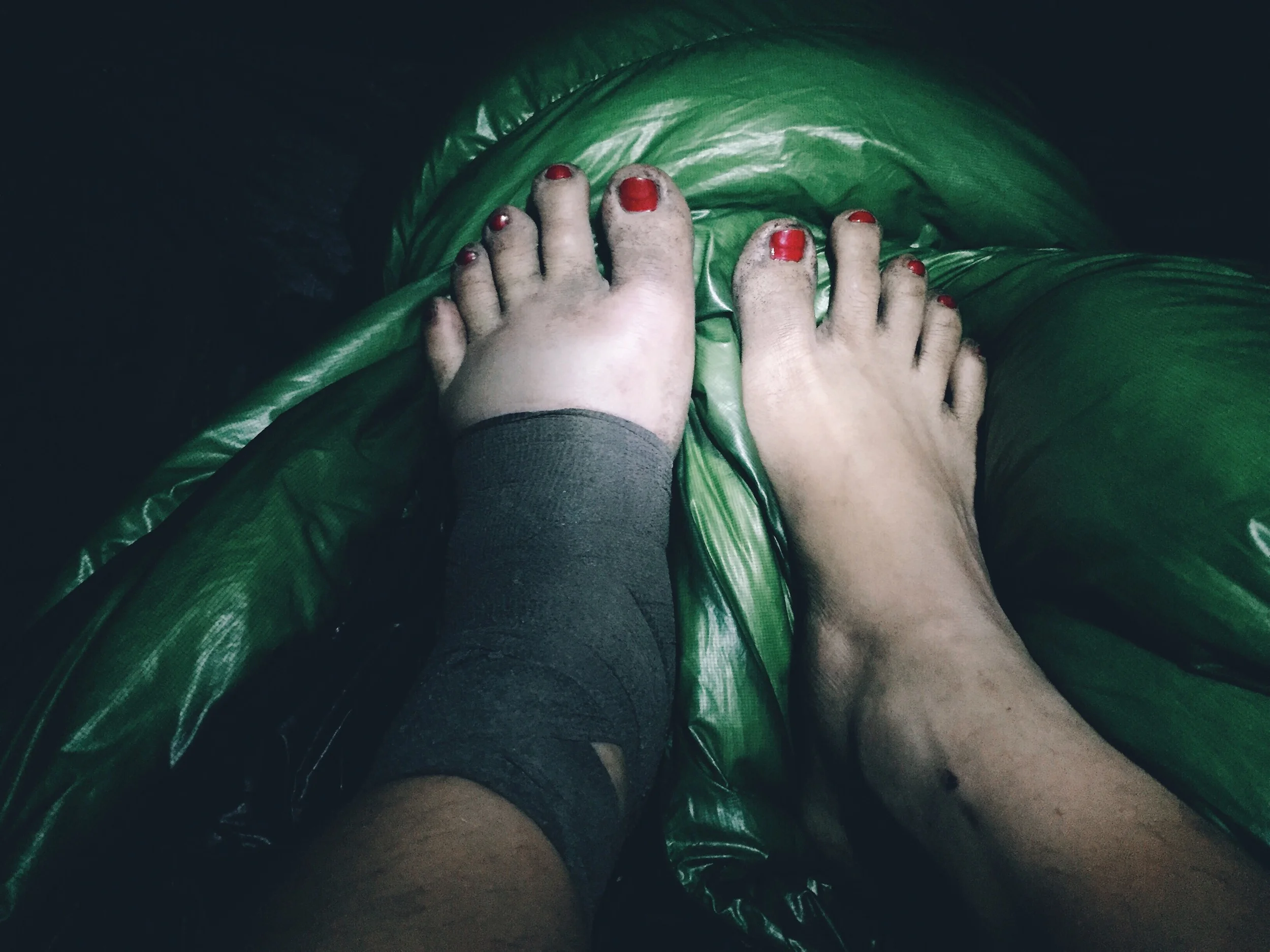 First morning after. Toes insanely huge.