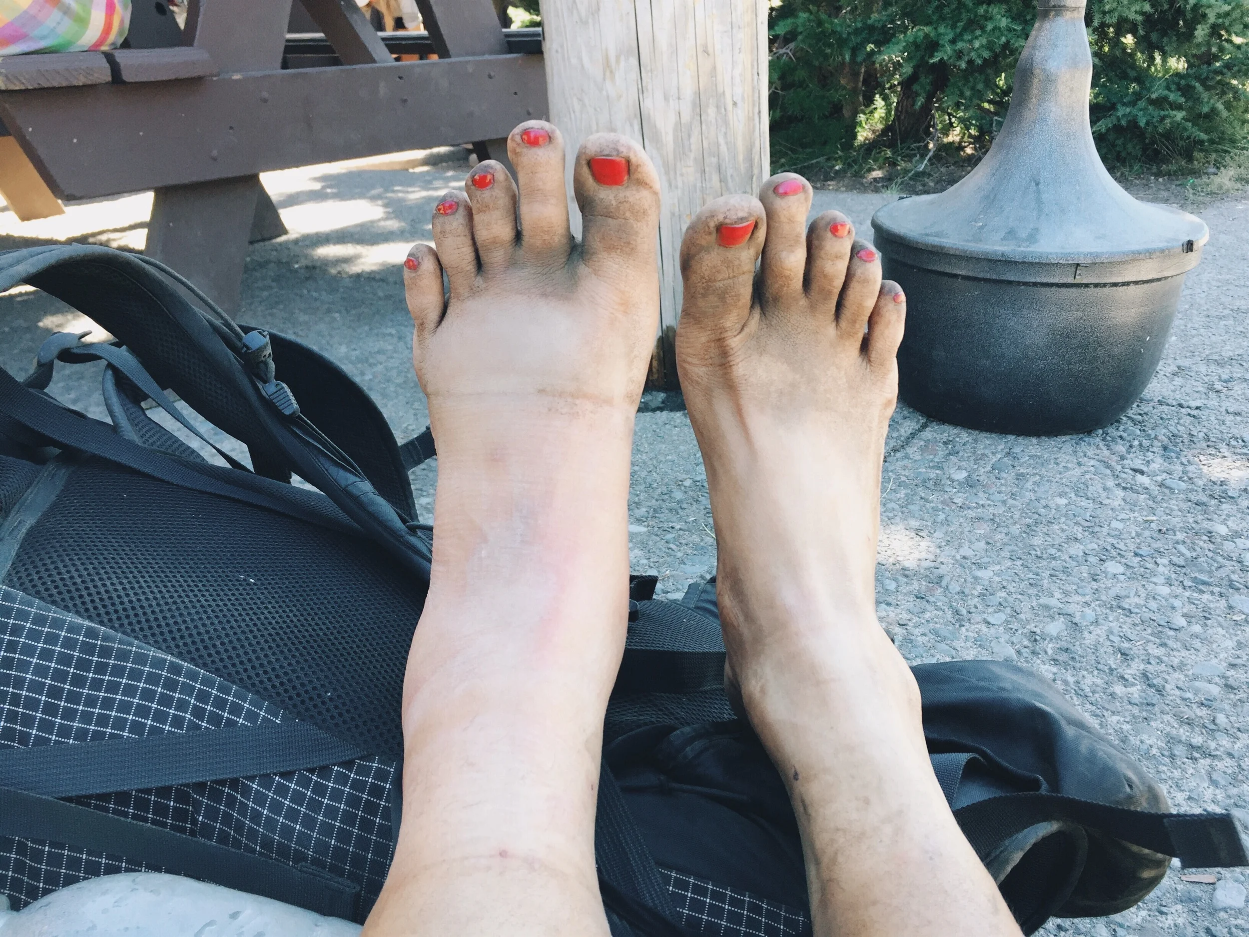 My feet looked crazy by the time I reached Mezama. 