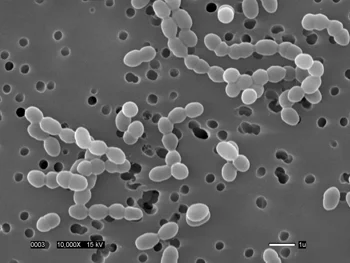 Fermentation and the Human Microbiome