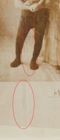 Before Treatment (Detail)