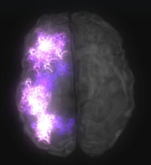 Inter-Hemispheric synchronization.png