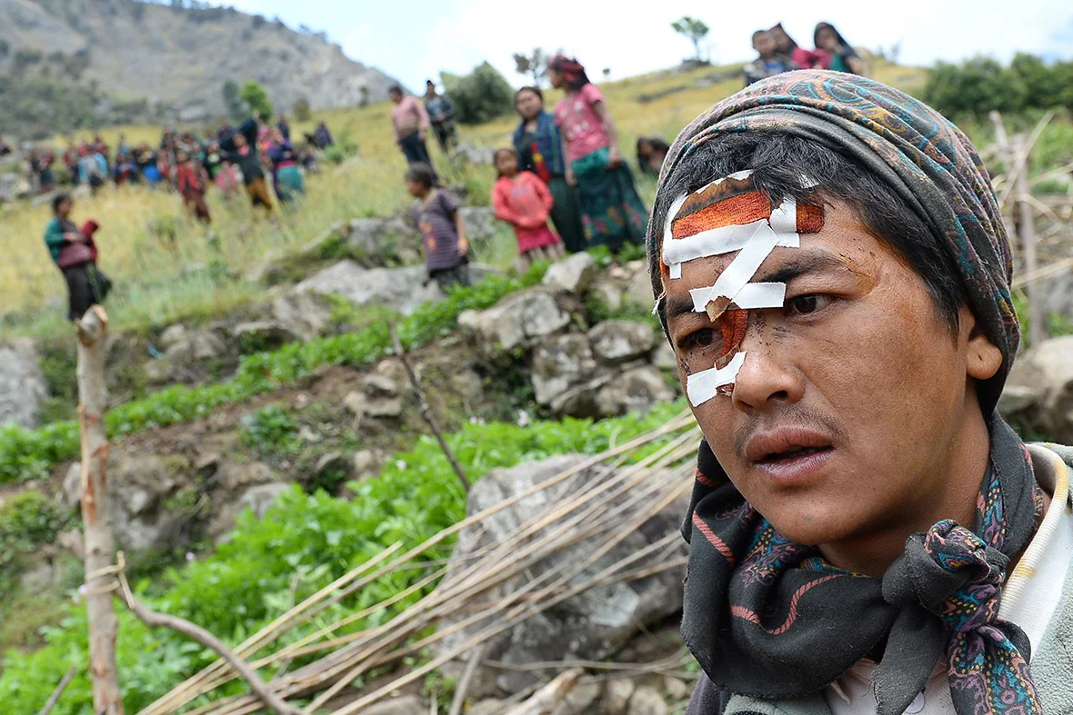 nepal-wounded man.jpg