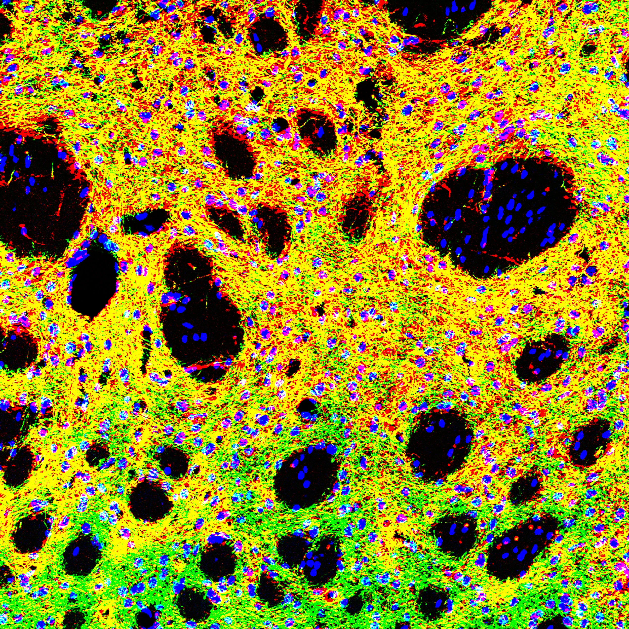3-color image of the dorsal striatum. Neurons (blue) are surrounded by axon terminals expressing ChR2-eYFP (green). In this preparation, they co-localize with terminals stained for tyrosine hydroxylase (red), producing a mostly yellow overlay.