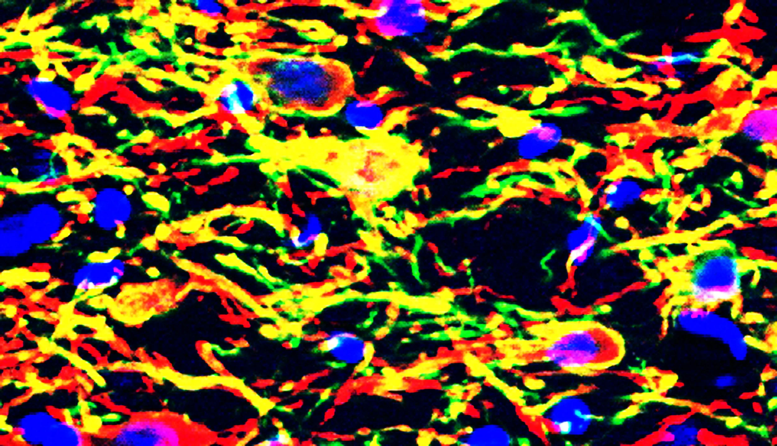 Midbrain neurons (blue). ChR2-eYFP expression (green) is restricted to tyrosine hydroxylase containing neurons (red), producing a mostly yellow overlay. 