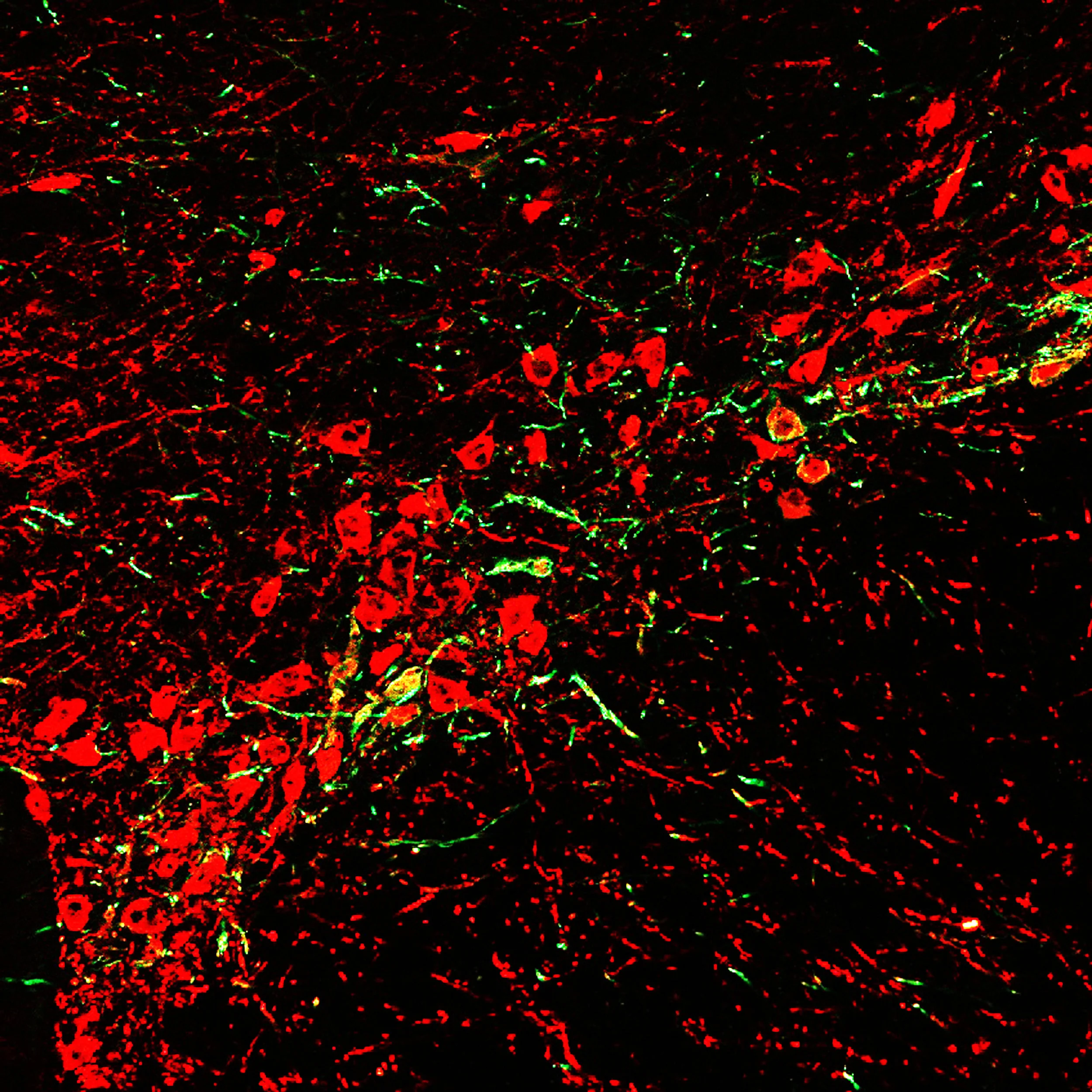 Neurons in the substantia nigra stained for tyrosine hydroxylase (red), expressing ChR2-eYFP from a retrograde viruse injected in the dorsal striatum.