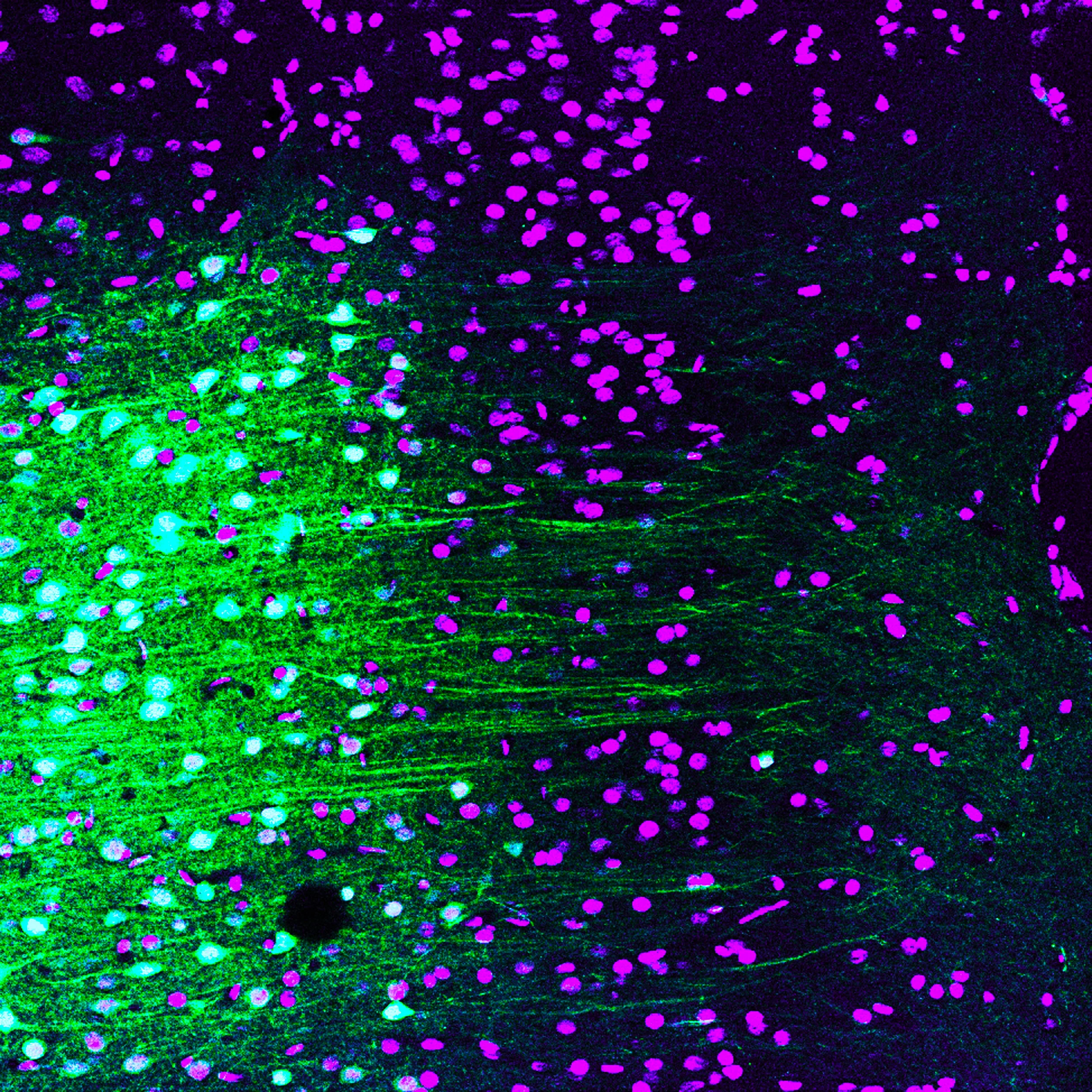 Neurons in the medial prefrontal cortex (purple) expressing GCaMPgf (green).