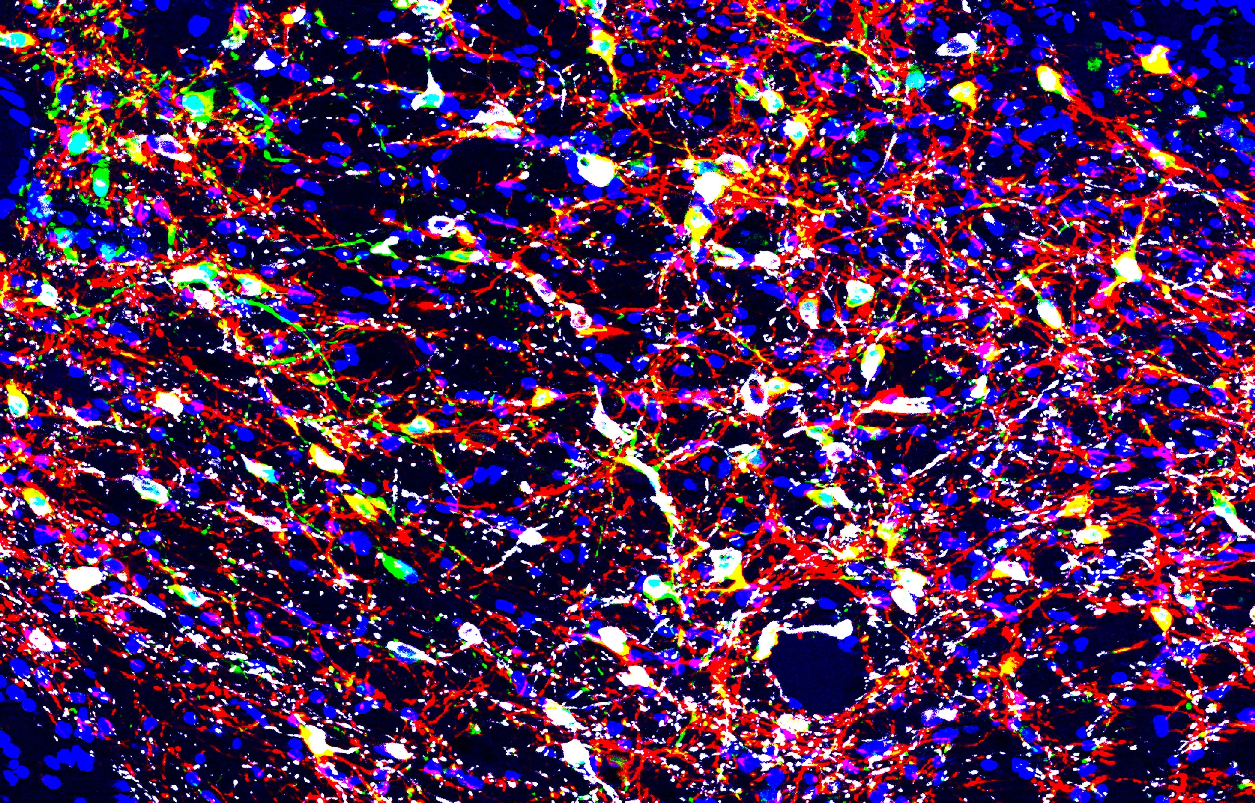 Image of the ventral tegmental area in the midbrain. Neurons (blue) were co-transfected with viruses containing GCaMP6f (green) and ChrimsonR-tdTomato (red). In this preparation, they overlap with neurons stained for tyrosine hydroxylase (white). 
