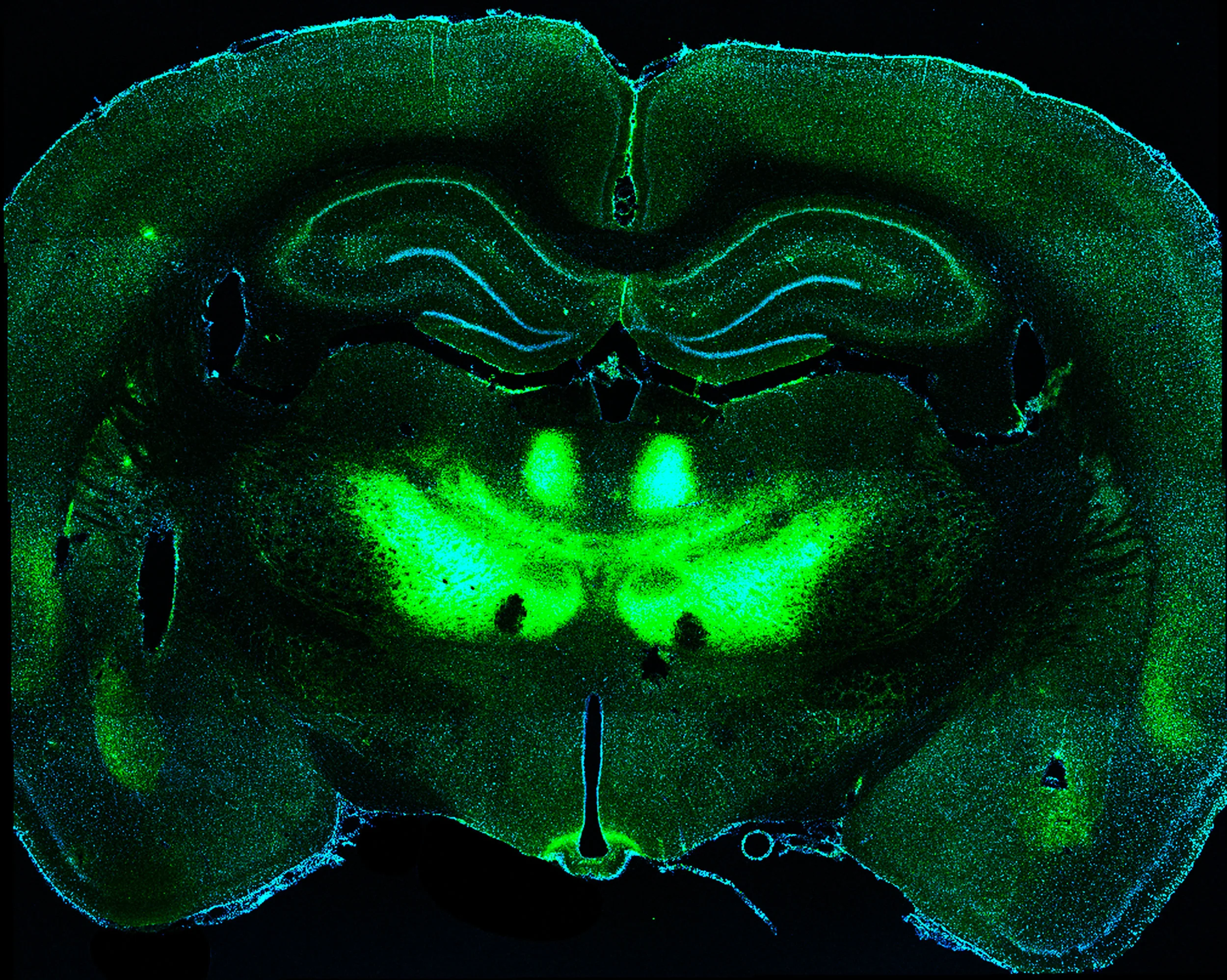 Whole brain coronal section image. Axon terminals from neurons in the orbitofrontal cortex expressing ChR2-eYFP (green) in the thalamus and basolateral amygdala. 