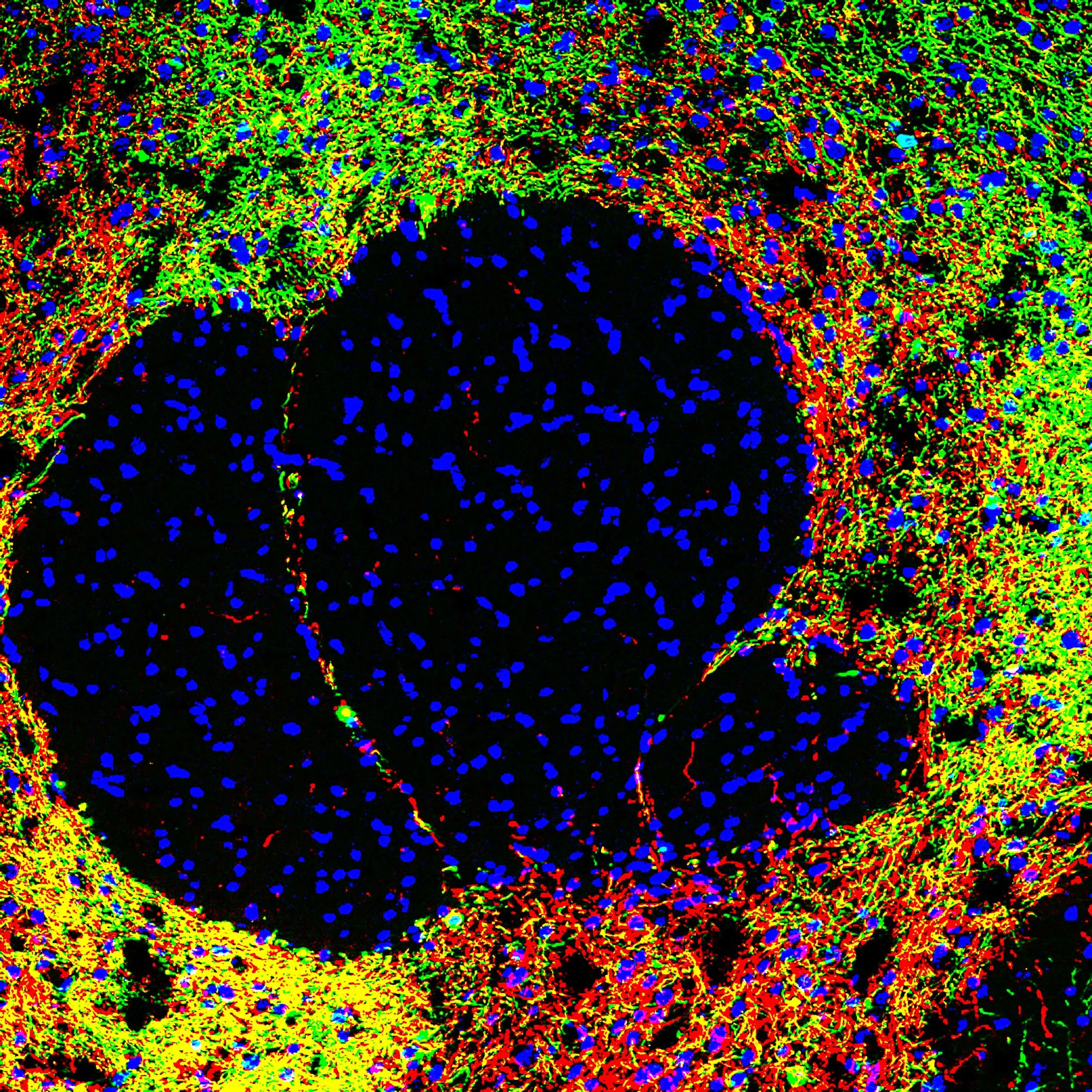 Nucleus accumbens core image. Neurons (blue) surrounded by axon terminals expressing ChR2-eYFP (green) that overlap with terminals stained for tyrosine hydroxylase (red). 