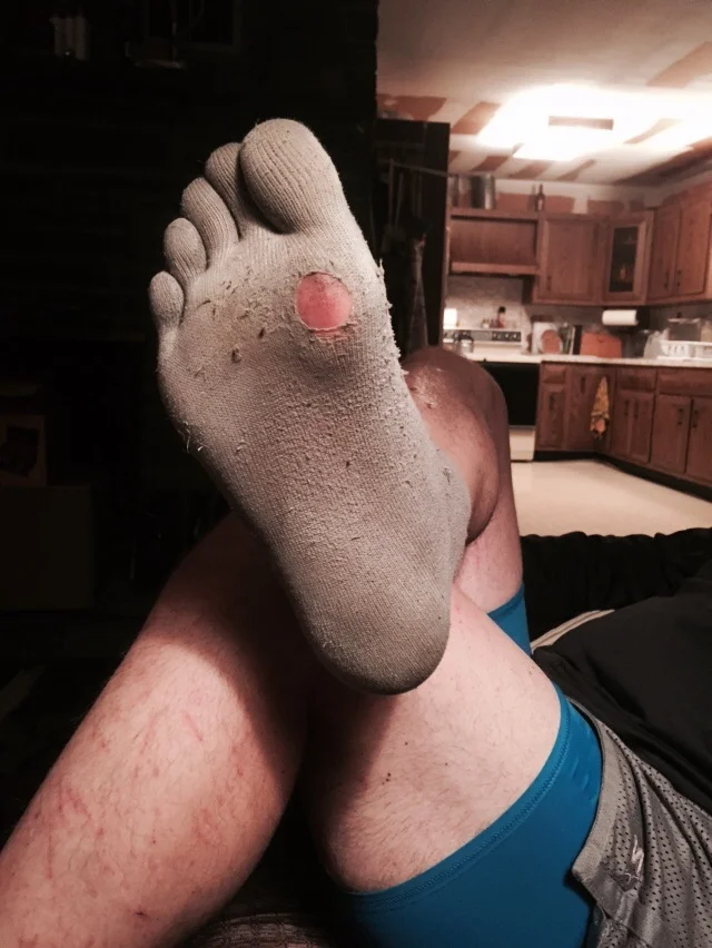 We hiked so fast and hard NoKey burned holes in his socks today!