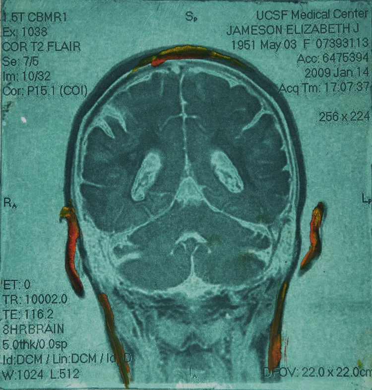 coronal-view-of-the-artists-brain-elizabeth-jameson.jpg