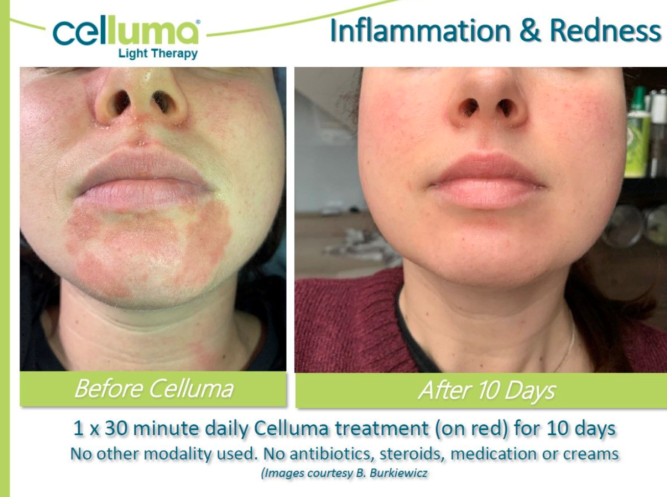 Celluma Light Therapy Root & Stem — root & stem