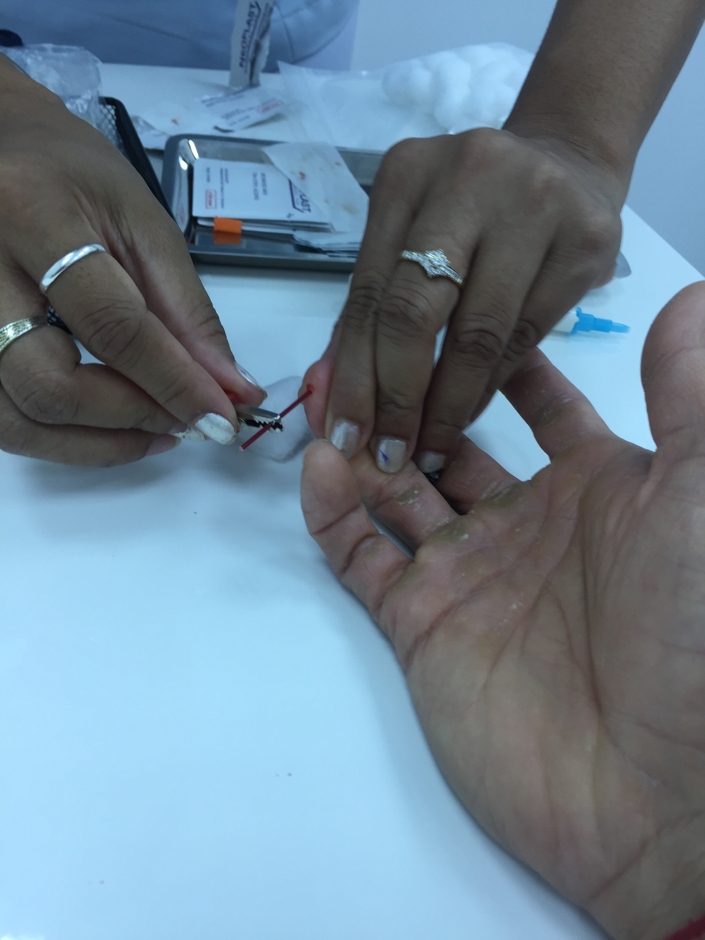 Oxidative stress test