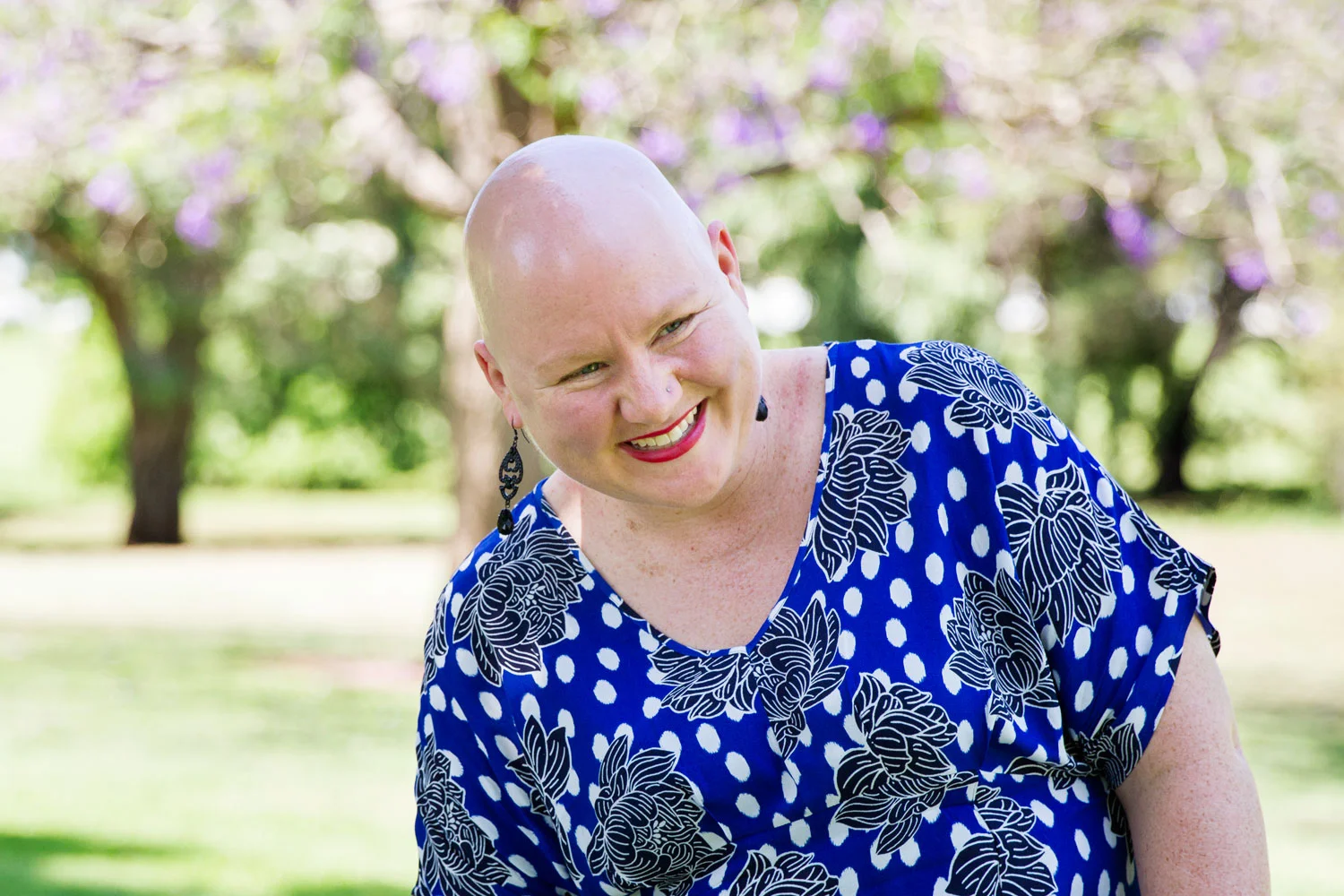 Sarah laughing and loving life in the park, the girl with no hair. bella magazine 