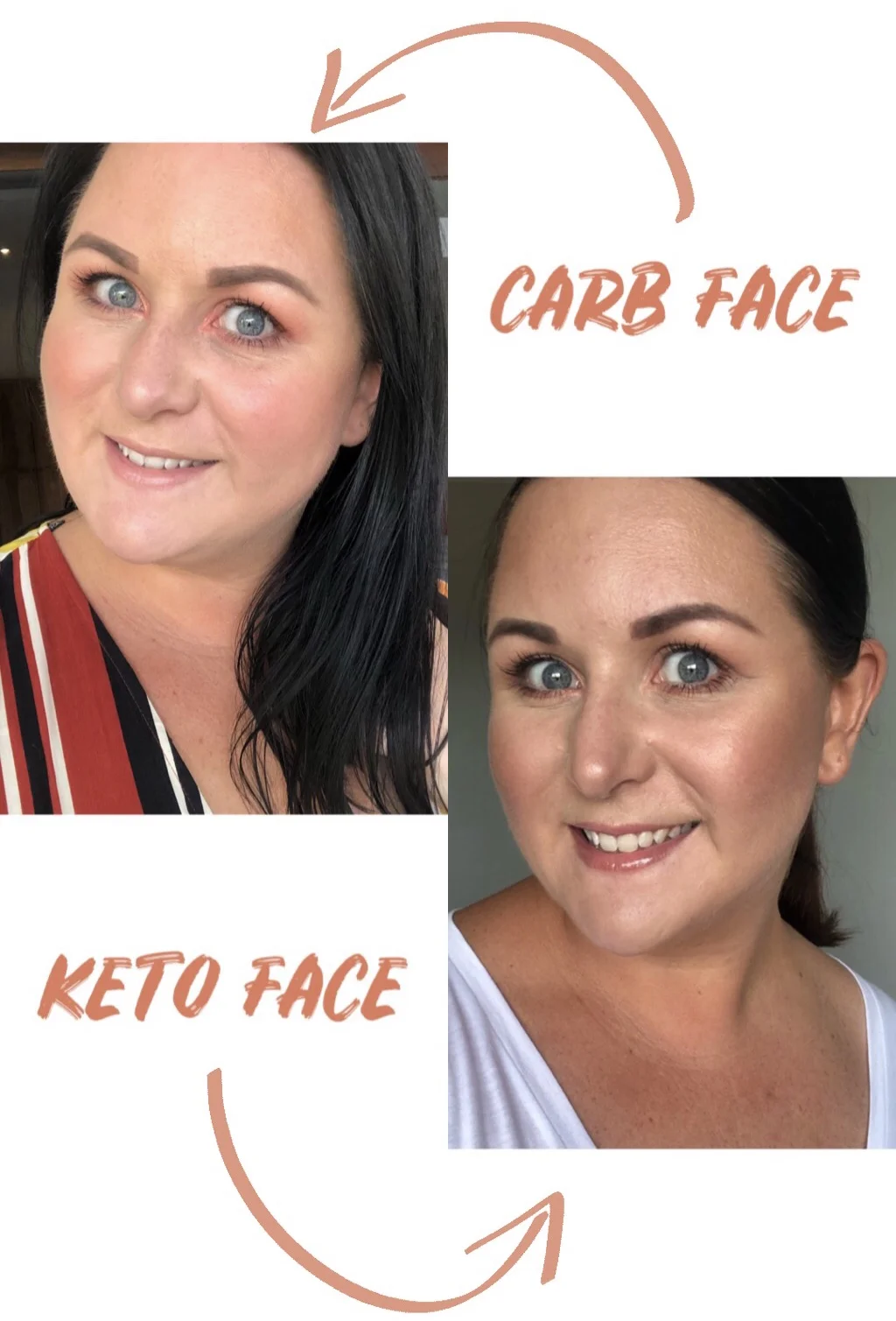 My Keto Transformation 15.8kg Weight Loss in 12 Weeks!