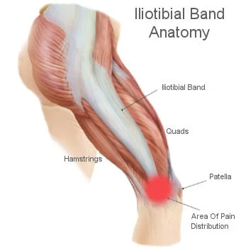 My Stomach Is Affecting My ITB (Iliotibial Band) Pain?