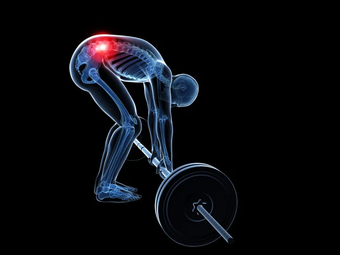 Deadlifting Will Destroy Your Back?
